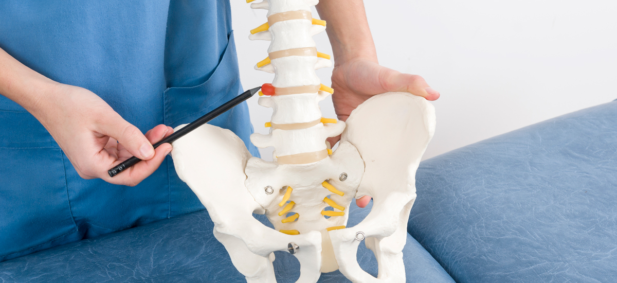 hernia-discal-en-fisioterapia